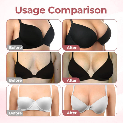 HISKIN® BREAST ENHANCEMENT  LIFT & FIRM MICRONEEDLE PATCHES
