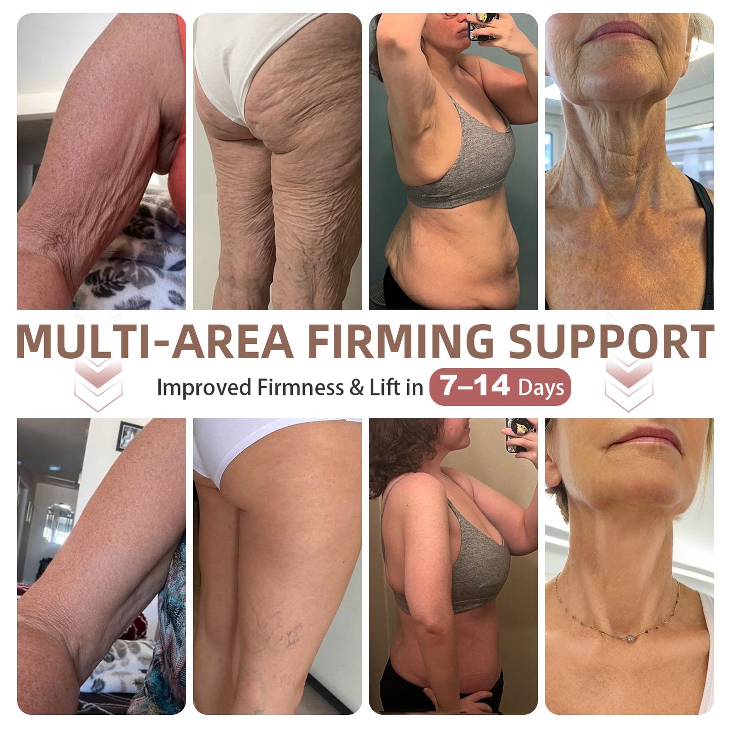 HISKIN® BREAST ENHANCEMENT  LIFT & FIRM MICRONEEDLE PATCHES