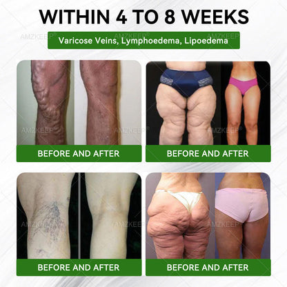 🇦🇺𝐓𝐨𝐝𝐚𝐲 𝐎𝐧𝐥𝐲 👑 𝐀𝐌𝐙𝐊𝐄𝐄𝐏® 𝟏𝟎-𝐢𝐧-𝟏 𝐀𝐝𝐯𝐚𝐧𝐜𝐞𝐝 𝐍𝐚𝐧𝐨 𝐌𝐢𝐜𝐫𝐨𝐧𝐞𝐞𝐝𝐥𝐞 𝐏𝐚𝐭𝐜𝐡✨ 𝐎𝐧𝐜𝐞 𝐝𝐚𝐢𝐥𝐲 · 𝐧𝐨𝐭𝐢𝐜𝐞𝐚𝐛𝐥𝐞 𝐜𝐡𝐚𝐧𝐠𝐞𝐬 𝐢𝐧 𝟕 𝐝𝐚𝐲𝐬✅ 𝐒𝐮𝐩𝐩𝐨𝐫𝐭𝐬 𝐰𝐞𝐢𝐠𝐡𝐭 𝐜𝐨𝐧𝐭𝐫𝐨𝐥 & 𝐛𝐨𝐝𝐲 𝐛𝐚𝐥𝐚𝐧𝐜𝐞✅ 𝐇𝐞𝐥𝐩𝐬 𝐢𝐦𝐩𝐫𝐨𝐯𝐞 𝐬𝐤𝐢𝐧 𝐟𝐢𝐫𝐦𝐧𝐞𝐬𝐬 & 𝐞𝐧𝐞𝐫𝐠𝐲🔥 𝐍𝐨 𝐢𝐧𝐣𝐞𝐜𝐭𝐢𝐨𝐧𝐬 · 𝐍𝐨 𝐩𝐢𝐥𝐥𝐬 · 𝐄𝐚𝐬𝐲 𝐫𝐨𝐮𝐭𝐢𝐧𝐞