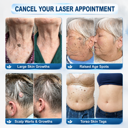 ✅𝐎𝐟𝐟𝐢𝐜𝐢𝐚𝐥 𝐁𝐫𝐚𝐧𝐝 𝐒𝐭𝐨𝐫𝐞 💎𝐇𝒊𝗦𝙆𝒊𝗡® 7-𝐷𝑎𝑦 𝗧𝐚𝐠 & 𝗦𝗽𝐨𝐭 𝐄𝐫𝒂𝒔𝒆𝒓(Zero Pain, Zero 𝐒𝐜𝐚𝒓𝒔 Rollerball)