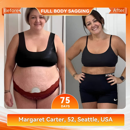 𝟐𝟓𝟎𝐭𝐡 𝐀𝐧𝐧𝐢𝐯𝐞𝐫𝐬𝐚𝐫𝐲 𝐄𝐱𝐜𝐥𝐮𝐬𝐢𝐯𝐞🗽𝑨𝑴𝒁𝑲𝑬𝑬𝑷® 𝑵𝑨𝑫+ 𝑴𝒐𝒓𝒊𝒏𝒈𝒂 𝑩𝒆𝒓𝒃𝒆𝒓𝒊𝒏𝒆 𝑵𝒂𝒏𝒐 𝑴𝒊𝒄𝒓𝒐𝒏𝒆𝒆𝒅𝒍𝒆 𝑷𝒂𝒕𝒄𝒉 𝐉𝐮𝐬𝐭 𝐨𝐧𝐜𝐞 𝐚 𝐝𝐚𝐲, 𝐯𝐢𝐬𝐢𝐛𝐥𝐞 𝐜𝐡𝐚𝐧𝐠𝐞𝐬 𝐢𝐧 𝟕 𝐝𝐚𝐲𝐬 𝙁𝙤𝙧𝙢𝙪𝙡𝙖 ✅ 𝐅𝐨𝐫 𝑺𝒖𝒑𝒑𝒐𝒓𝒕𝒔 𝑴𝒆𝒕𝒂𝒃𝒐𝒍𝒊𝒔𝒎, 𝑾𝒆𝒊𝒈𝒉𝒕 𝑴𝒂𝒏𝒂𝒈𝒆𝒎𝒆𝒏𝒕, 𝑯𝒆𝒂𝒓𝒕 𝑯𝒆𝒂𝒍𝒕𝒉, O𝐛𝐞𝐬𝐢𝐭𝐲, 𝗟𝗼𝗼𝘀𝗲 S𝗸𝗶𝗻, D𝐢𝐚𝐛𝐞𝐭𝐞𝐬, S𝐥𝐞𝐞𝐩 A𝐩𝐧𝐞𝐚, J𝐨𝐢𝐧𝐭 I𝐬𝐬𝐮𝐞𝐬